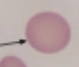 <p>what is it (Abnormalities)</p>