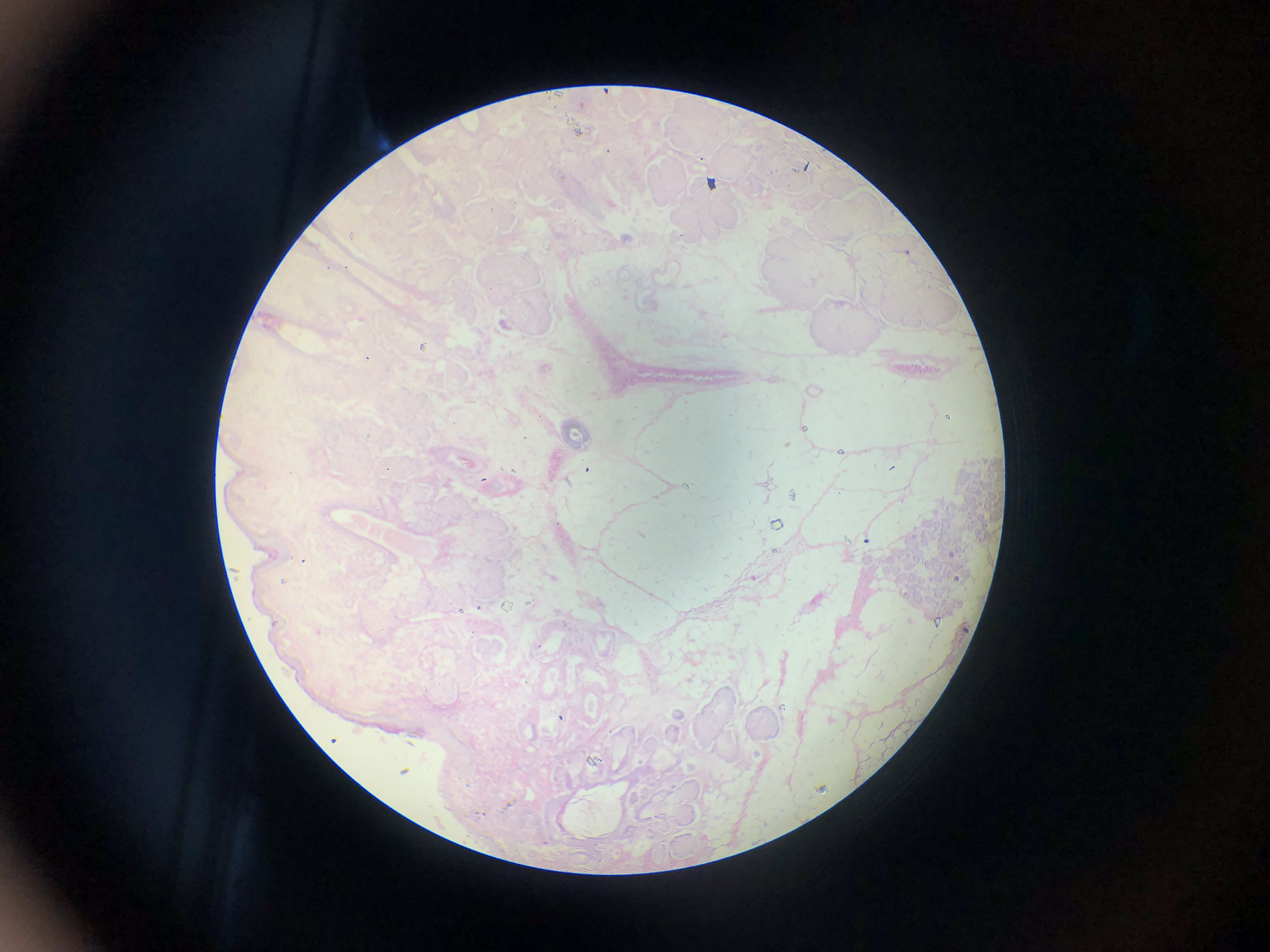 <p>What is the diagnosis?</p>