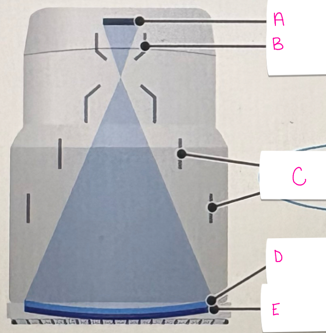 <p>what does letter A demonstrate</p>