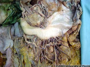 <p>what artery is being indicated to in the image? context: left lobe of liver has been removed</p>