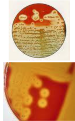 <p>What type of hemolysis would you expect if a sample is believed to be Staphylococcus aureus on blood agar?</p>