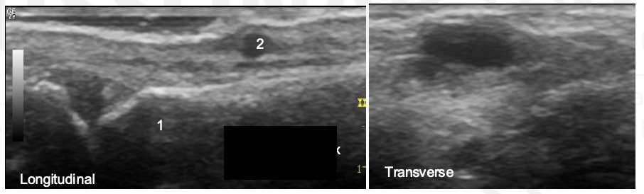 <p>What are 1 and 2?</p>
