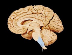 <p>the base of the brainstem; controls heartbeat and breathing. responsible for sneezing and coughing too</p>
