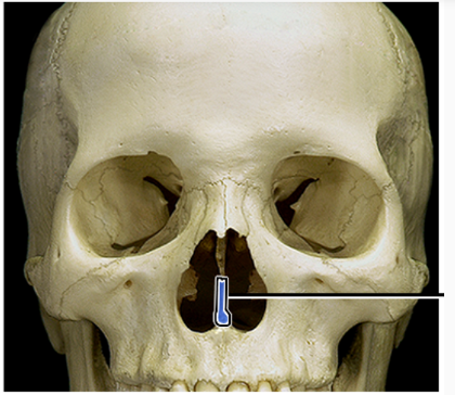 <p>What structure is indicated</p>