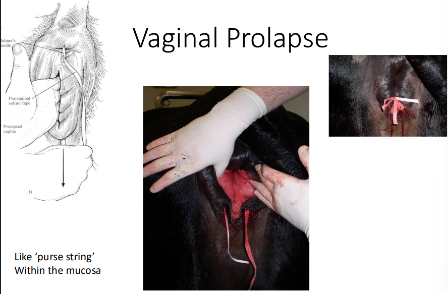 <ul><li><p>assess viability of tissue</p></li><li><p>clean and apply lube</p></li><li><p>replace back into vagina</p></li><li><p>Buhner’s stitch with <strong>uterine tape</strong></p><ul><li><p>or horizontal mattress</p></li><li><p>2-3 fingers wide (need to pass U+)</p></li><li><p>easy knot</p></li></ul></li><li><p>NSAID, broad spectrubs abs</p></li></ul><p></p>