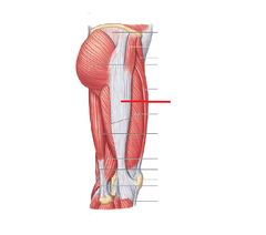 <p>A thickened strip of fascia on the lateral side of the thigh that runs from the hip to the tibia. It helps stabilize the hip and knee, especially during movement.</p>