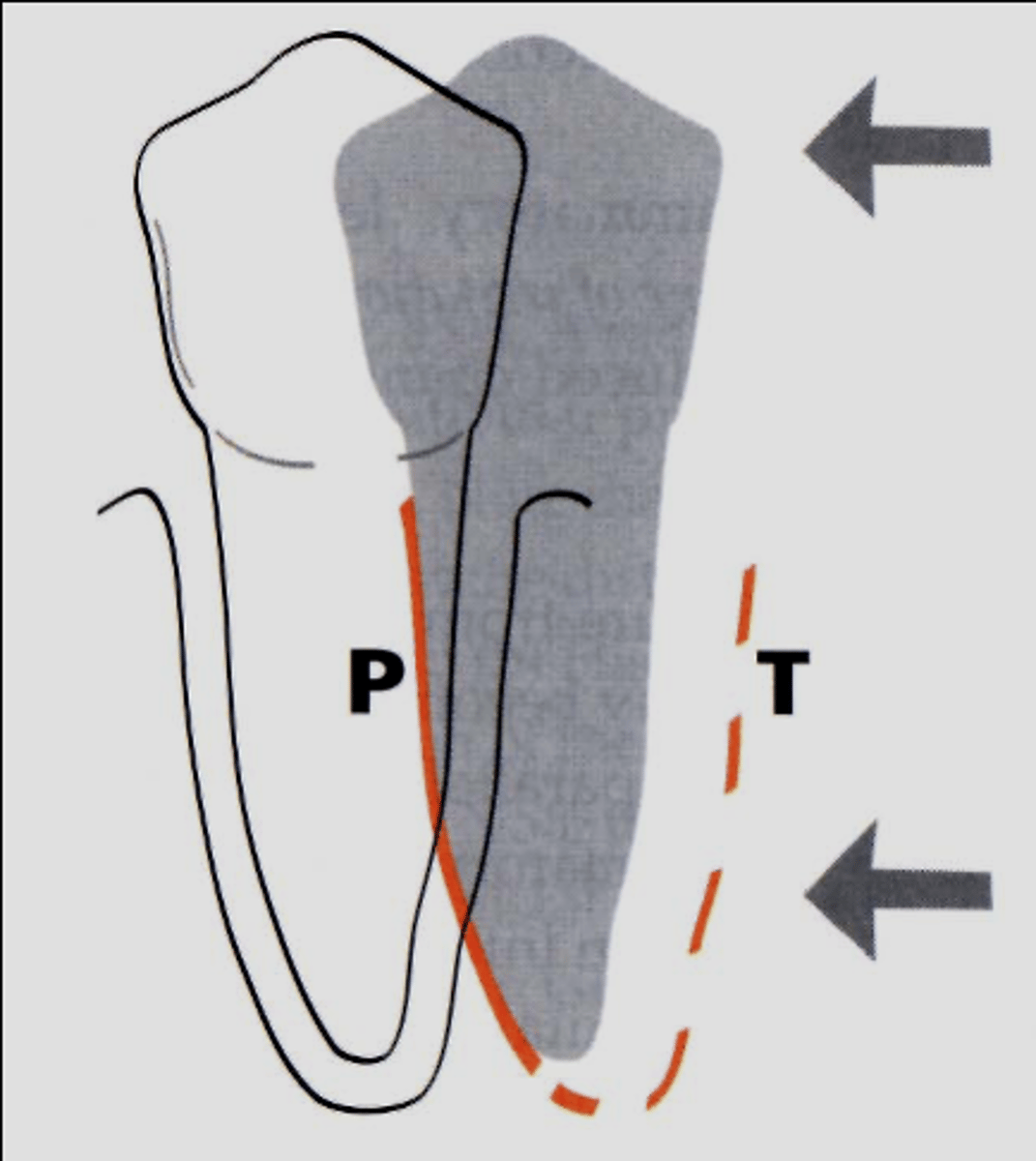 <p>What type of movement is shown here?</p>
