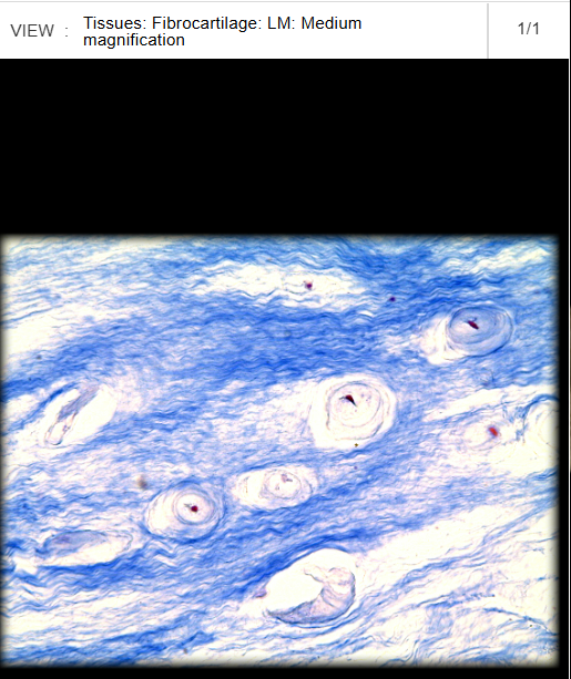 <p>Medial meniscus</p>