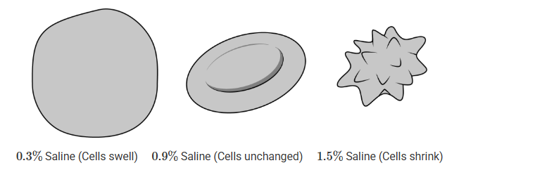 <p><span>Intravenous </span>(IV) <span> therapy is used for fluid replacement in instances of dehydration in humans and other animals. One type of IV fluid is essentially a saltwater solution. To determine the best concentration for therapy in people, a team of students is researching the effects of solutions of different salt concentrations on red blood cells. The following observations were made from three different red blood cell samples viewed under a microscope.</span></p><p>The team wants to extend the research project. What should the team of students do next to obtain data that are more conclusive?</p><p>A) Repeat the process with other salt concentrations.</p><p>B) Develop a model to explain why the cells react differently to different salt concentrations.</p><p>C) Repeat the process using red blood cells from other animals.</p><p>D) Develop an experimental procedure that uses a stain that makes the organelles of red blood cells more visible.</p>
