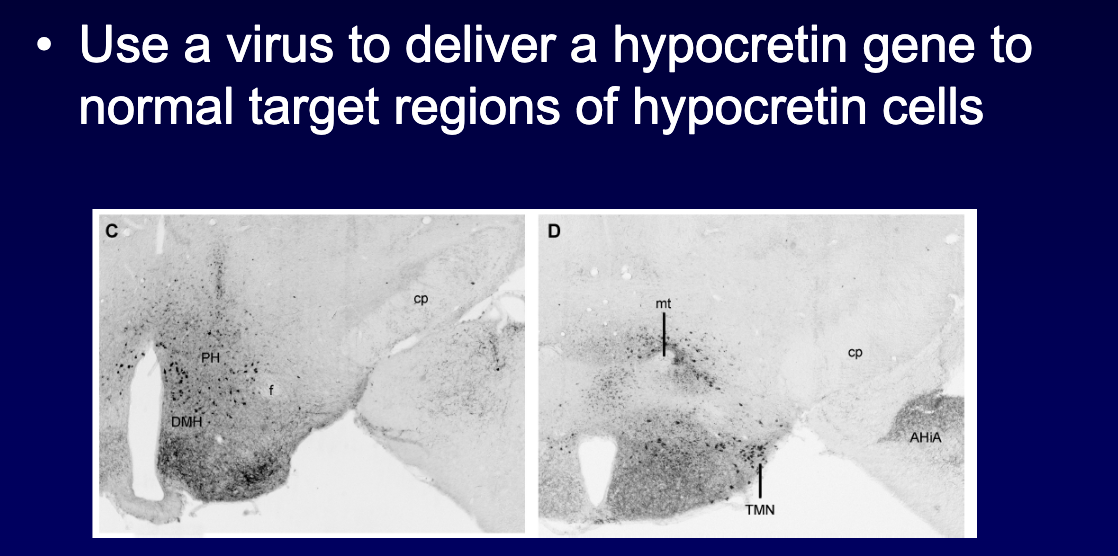 <ul><li><p>Virus delivered hypocretin to target regions → <strong>improved REM, NREM, and wakefulness</strong></p></li><li><p><strong>Normalized wake bout duration</strong></p></li><li><p><strong>Maybe small drop in cataplexy</strong> (depends on area treated)</p></li></ul><img src="https://assets.knowt.com/user-attachments/617f29bc-1e20-47b1-b6b0-1f92f7aafe6d.png" data-width="100%" data-align="center"><img src="https://assets.knowt.com/user-attachments/d38a0b07-ad1b-4791-99fd-8e4b205a1ea4.png" data-width="100%" data-align="center"><p></p>