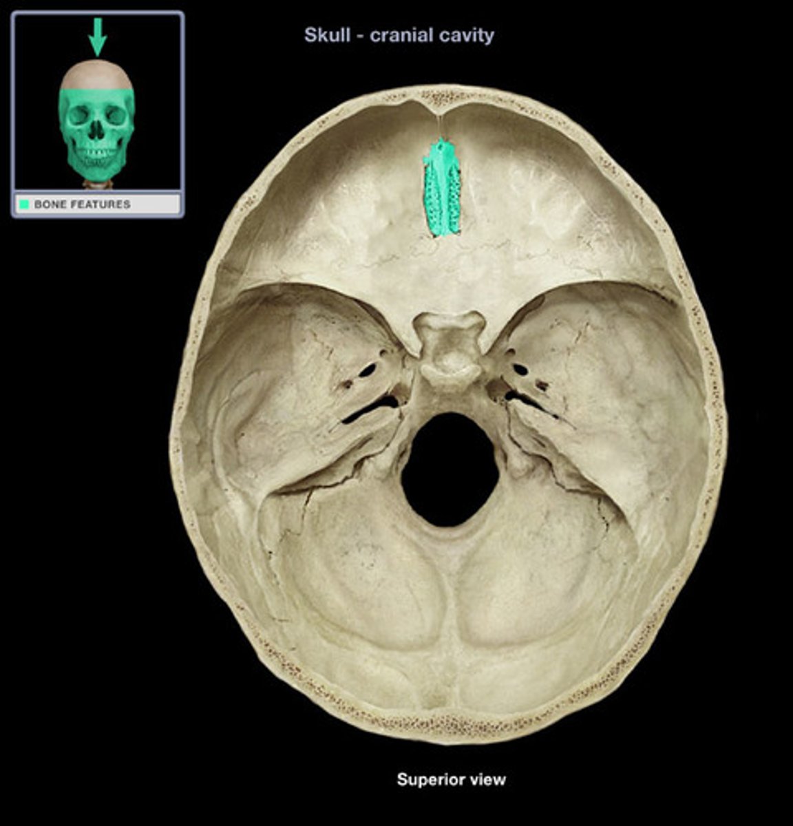 <p>ID highlighted bone</p>