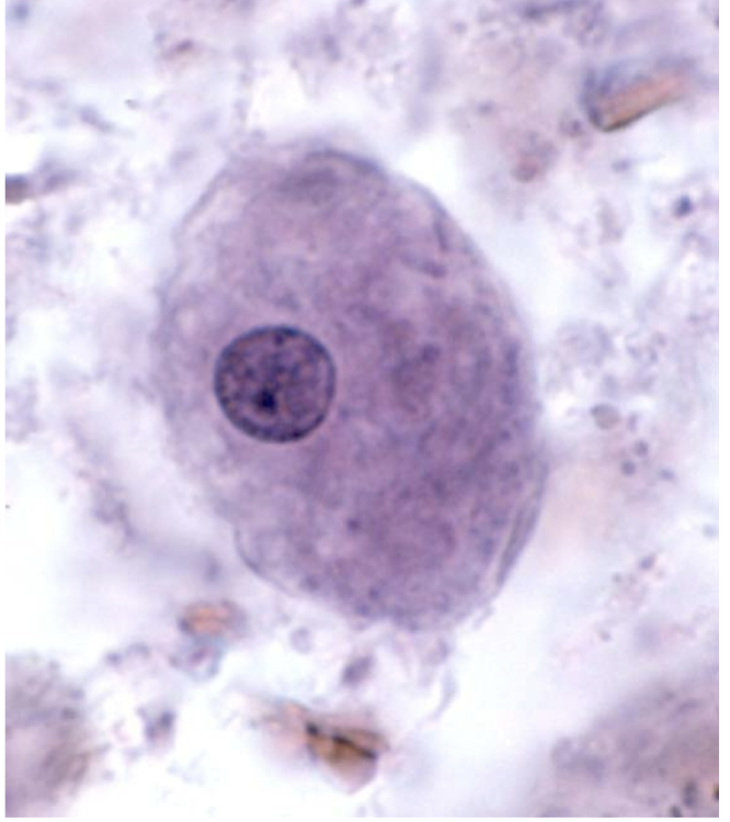 <p>-20-25 microns</p><p>-Eccentric karyosome</p><p>-Clumpy peripheral chromatin</p>