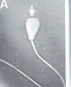 <p>What is this? Normal or abnormal sperm?</p>