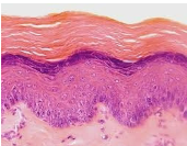 <p>• Multiple cell layers with dead cells that are flat and scaly at surface</p><p>• Resists mechanical injury (abrasion), prevents water loss through skin; resists</p><p>penetration by pathogenic organisms</p><p>• Epidermis of skin</p>