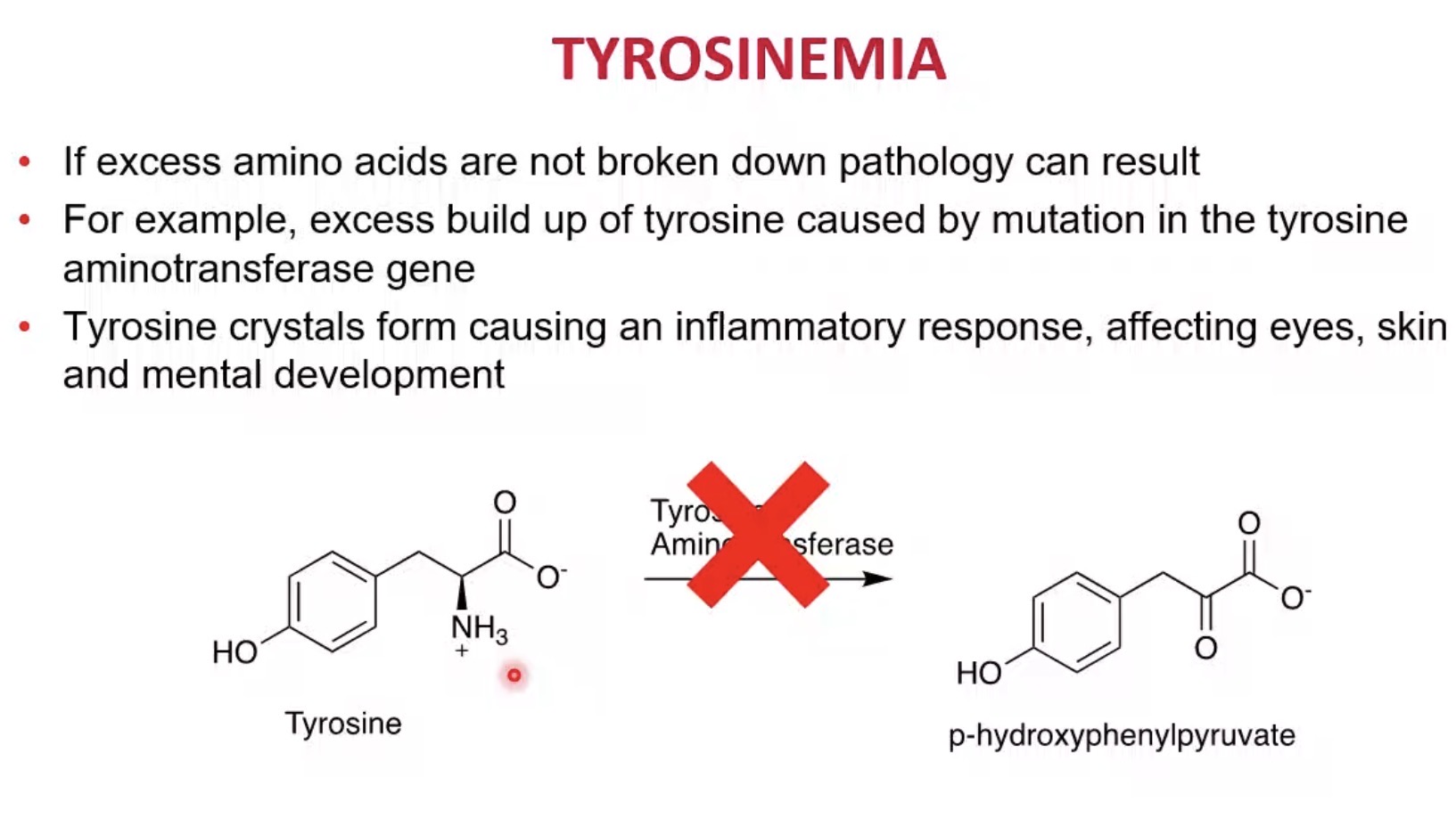 <p>A disorder caused by impaired tyrosine metabolism.</p>