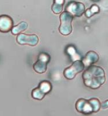 <p>what crystal; alk or acid</p>