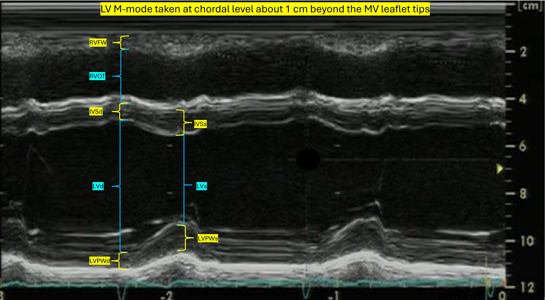 <p>RVOT</p>