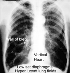 <p>film based or digitally produced recording of anatomic structures</p>