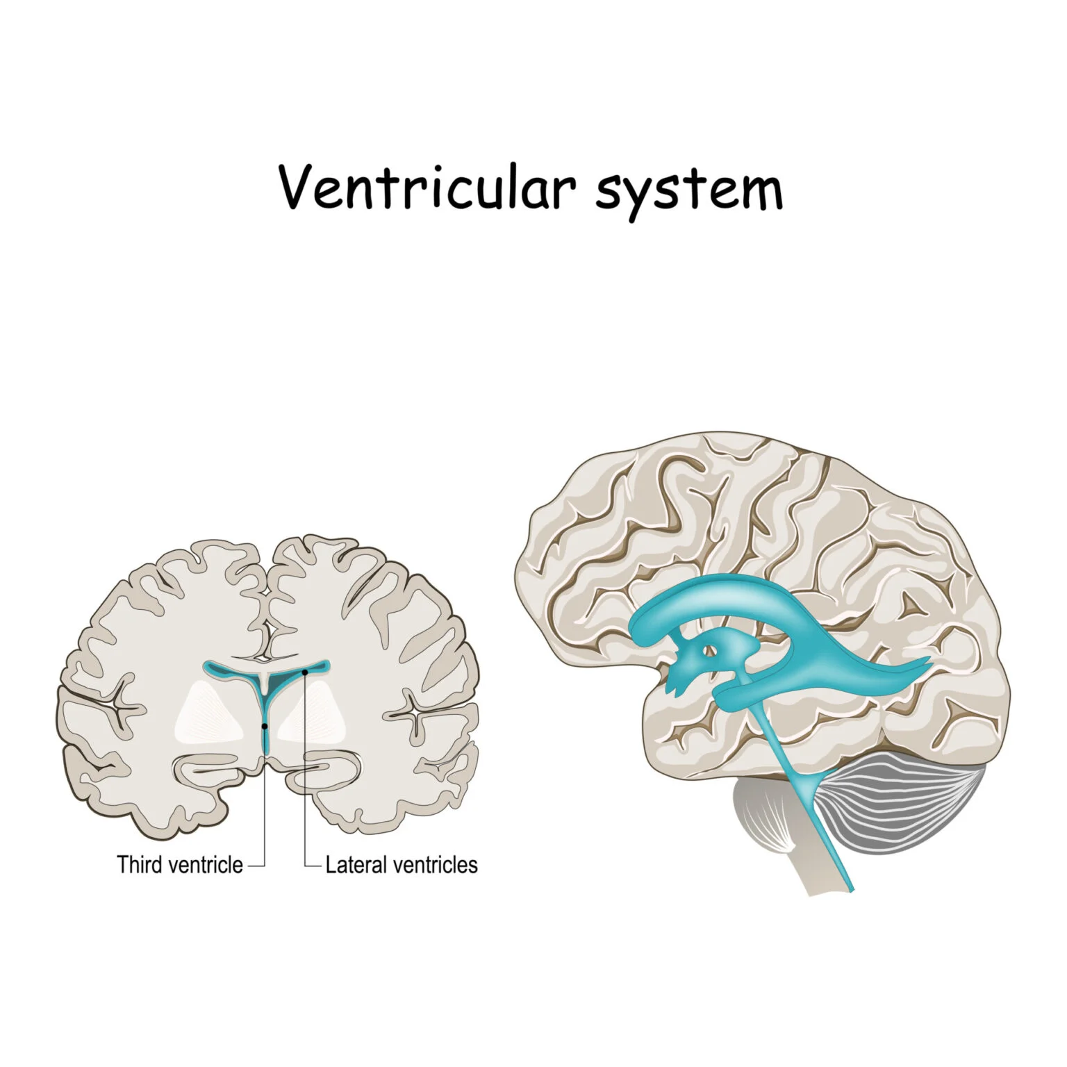 <p>Third Ventricles</p>