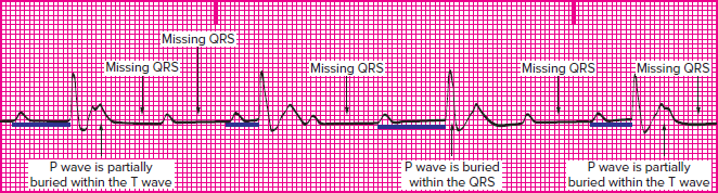 <p>Which rhythm is this?</p>