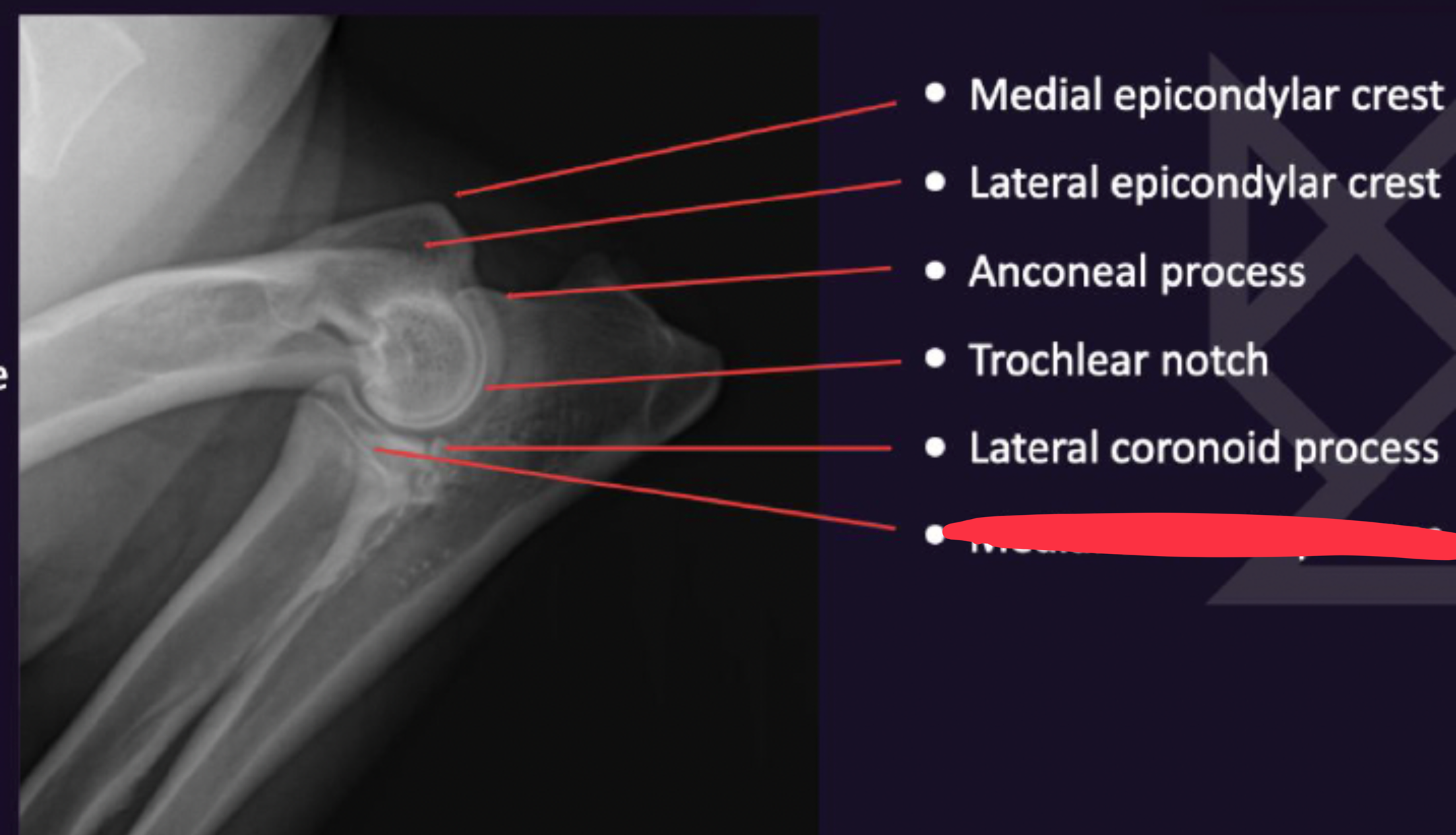 term image