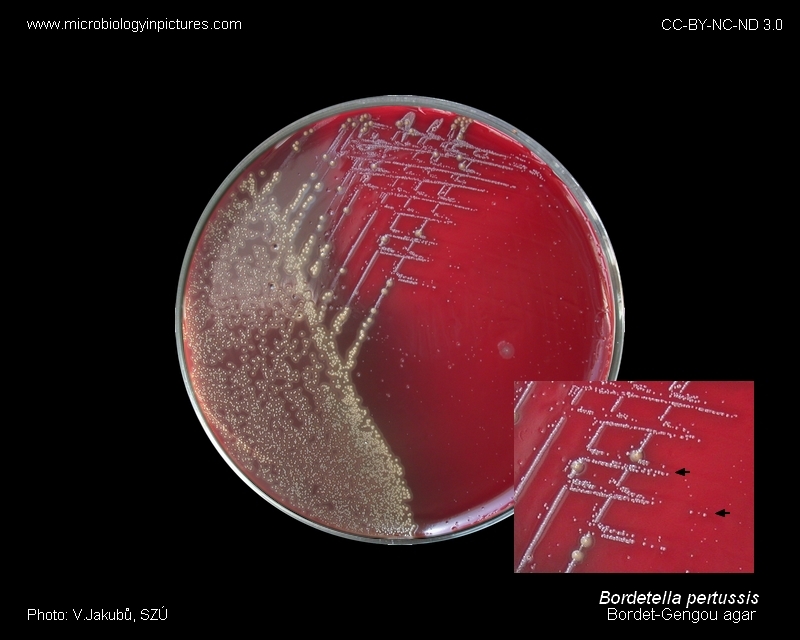 <p>collect 2 nasopharyngeal swabs (Dacron swabs)</p><p><strong>plate one</strong> on either Bordet Gengou or Regan-Lowe media</p><p><strong>second swab</strong> used for DFA or PCR</p>