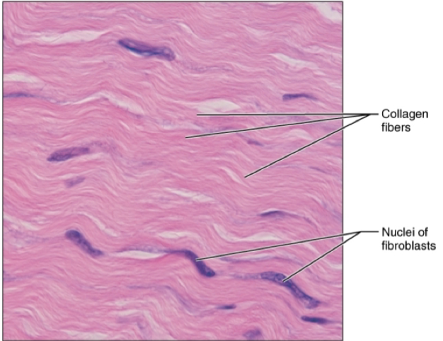 <ul><li><p>location: tendons, most ligaments, eponeuroses</p></li><li><p>function: attaches muscle to bones and w/stands great stress when pulled in ONE direction.</p></li><li><p>tightly binds body parts</p></li></ul><p></p>