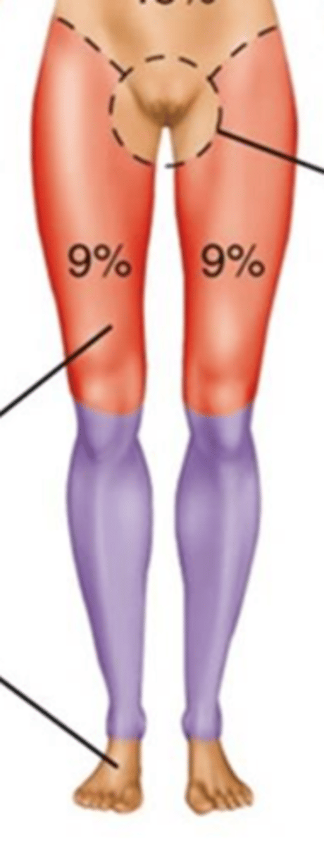 <p>14%</p>
