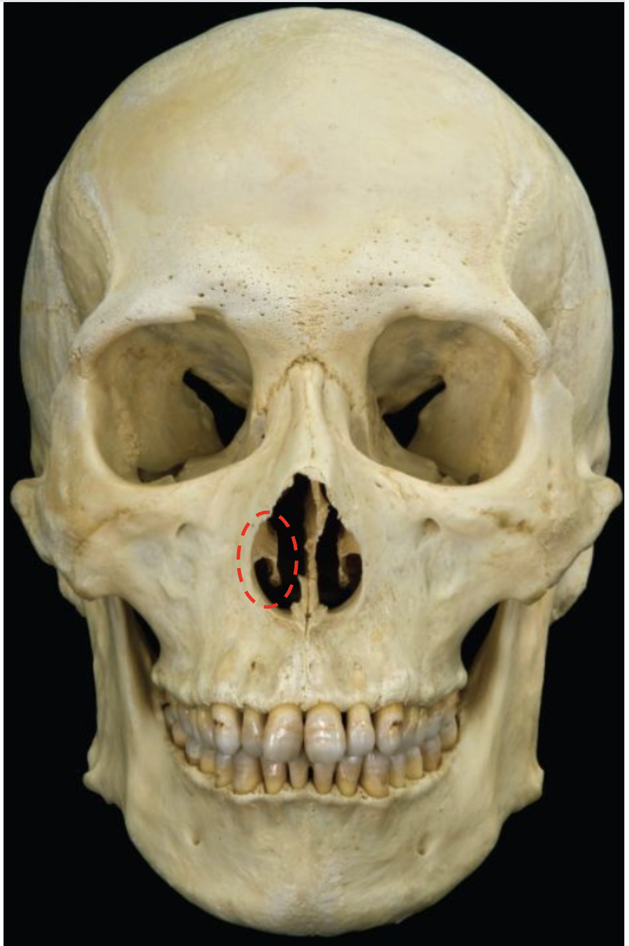 <p>Inferior nasal conchae</p>