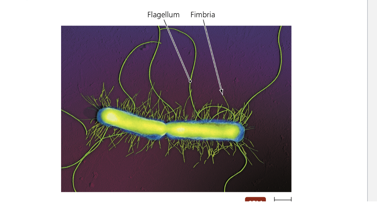 <p>Fimbriae and their role in infection </p>