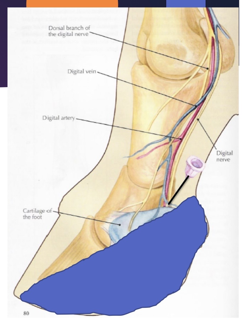 <p>what nerve block is this?</p>