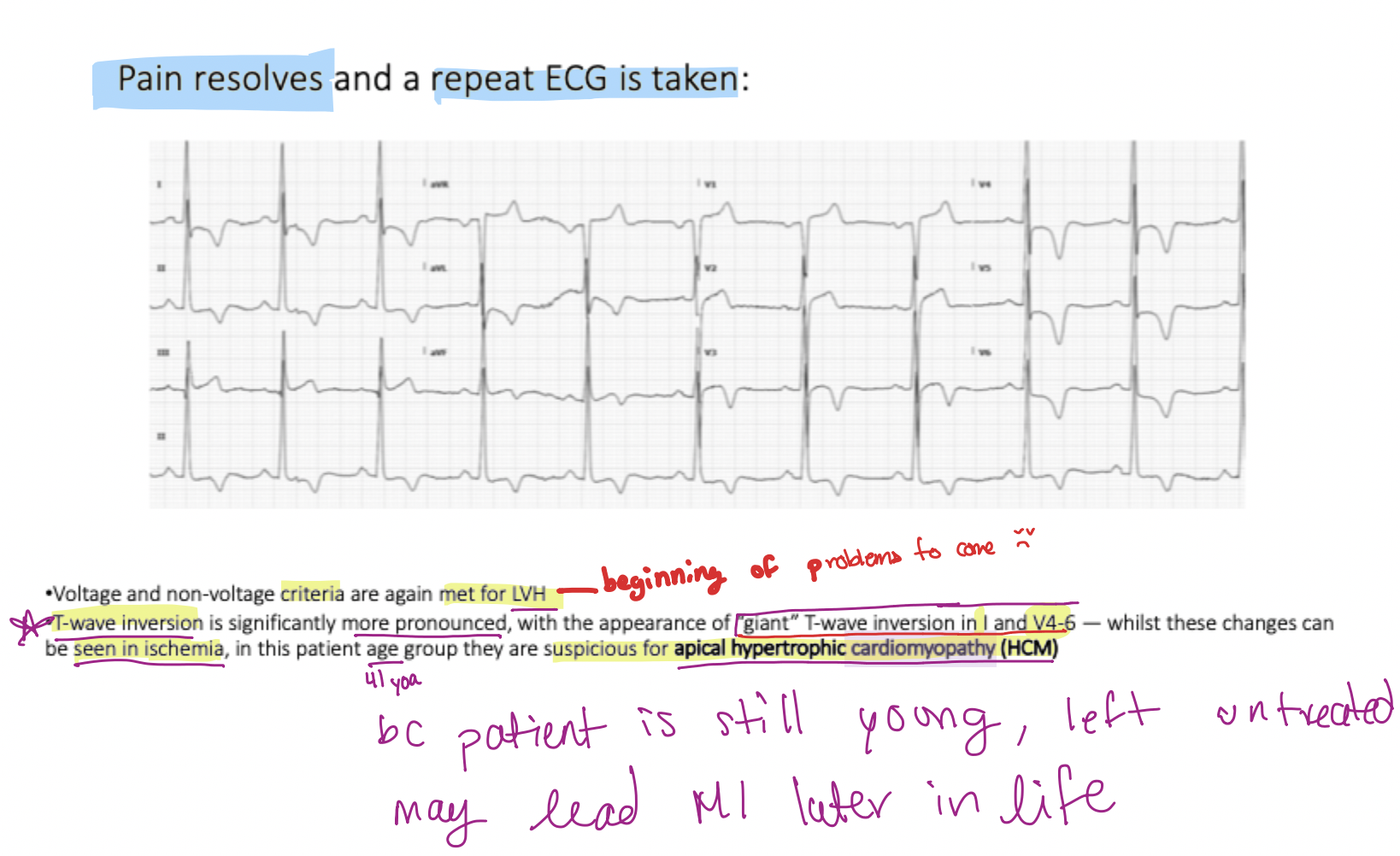 <p><strong>Apical <u>Hype</u>rtrophic Cardiomyopathy</strong> (HCM)</p>
