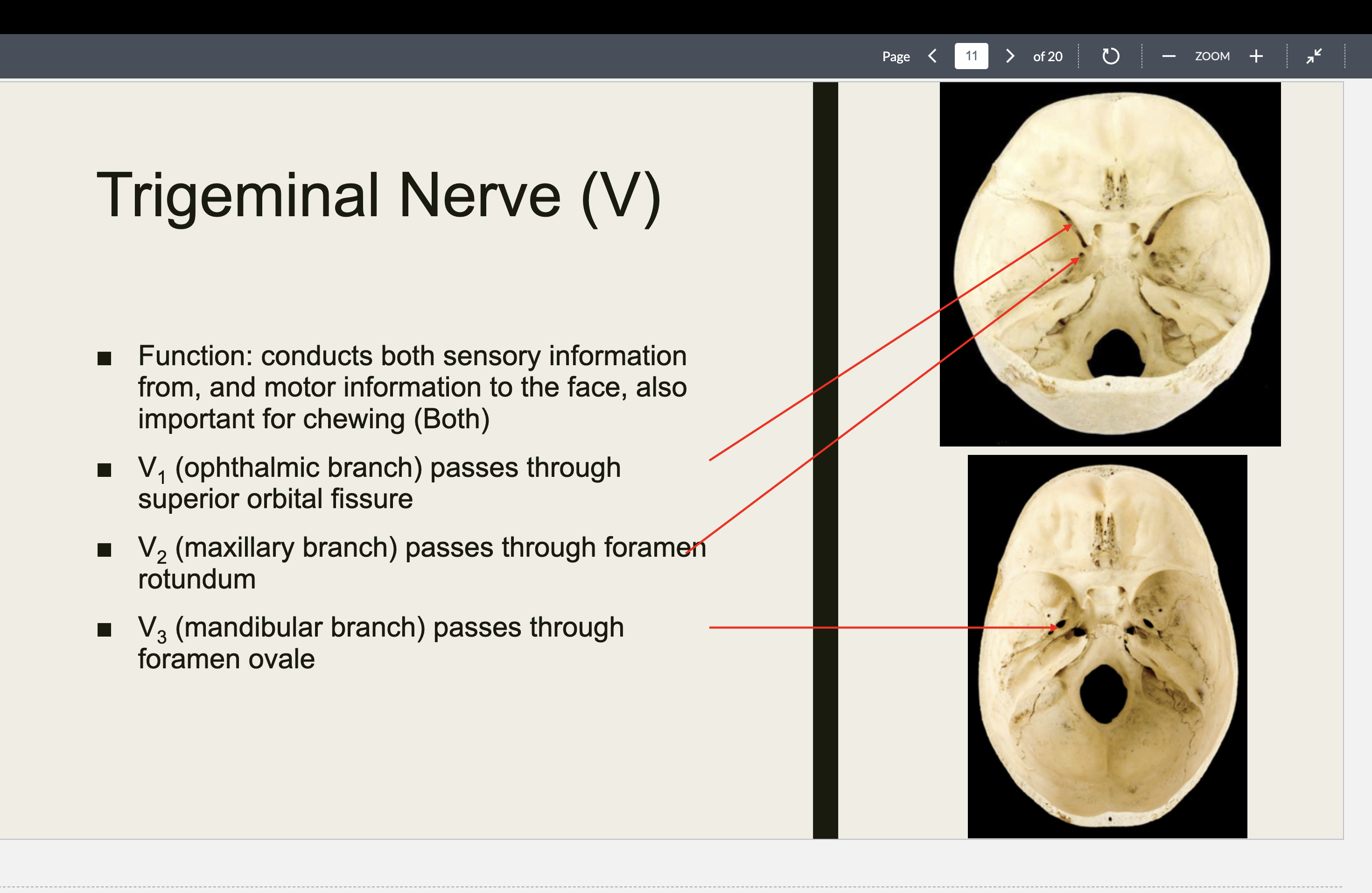 <p>Trigeminal Nerve (V)</p><p>■ Function: conducts both XX information</p><p>from, and XX XX to the face, also</p><p>important for XX (XX)</p><p>■ V1 (XX branch) passes through XX XX XX</p><p>■ V2 (XX branch) passes through XX XX</p><p>■ V3 (XX branch) passes through XX XX</p><p></p>