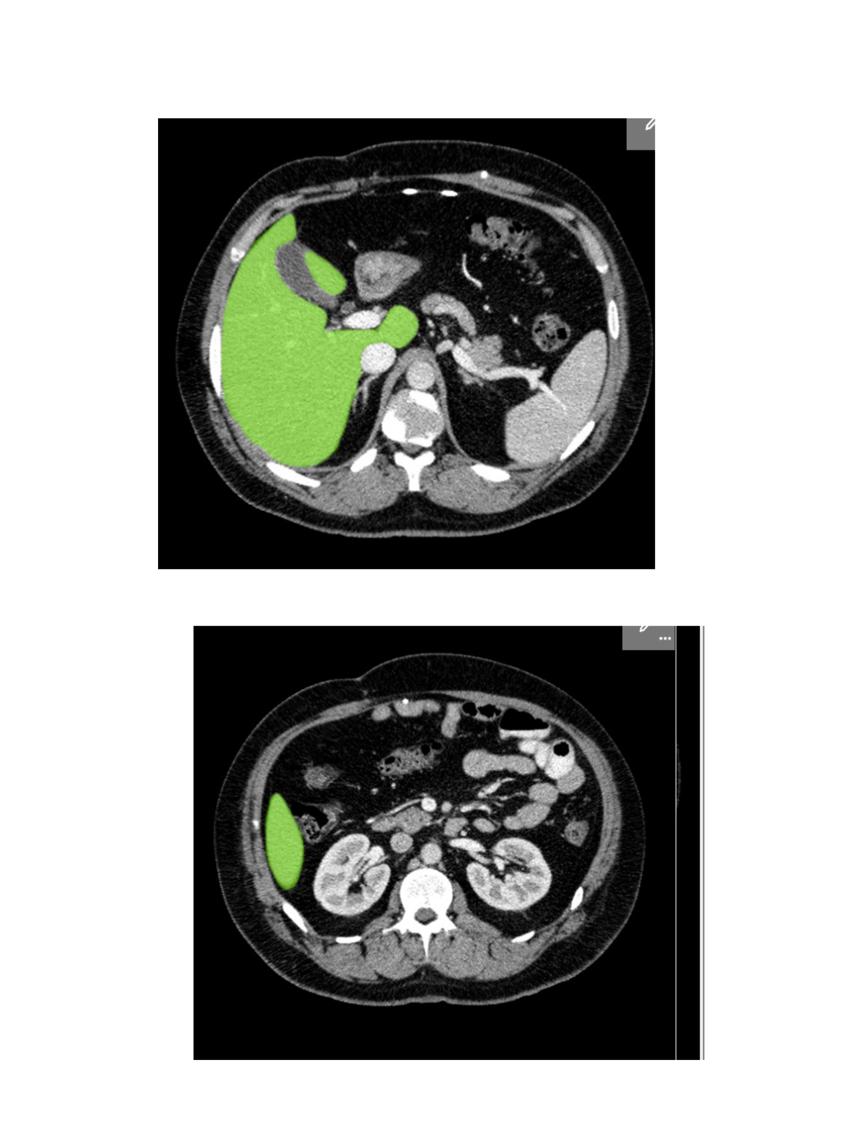 <p>Liver</p>