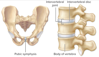 <p>united by cartilage (symphyses like in hip bones or spine)</p>