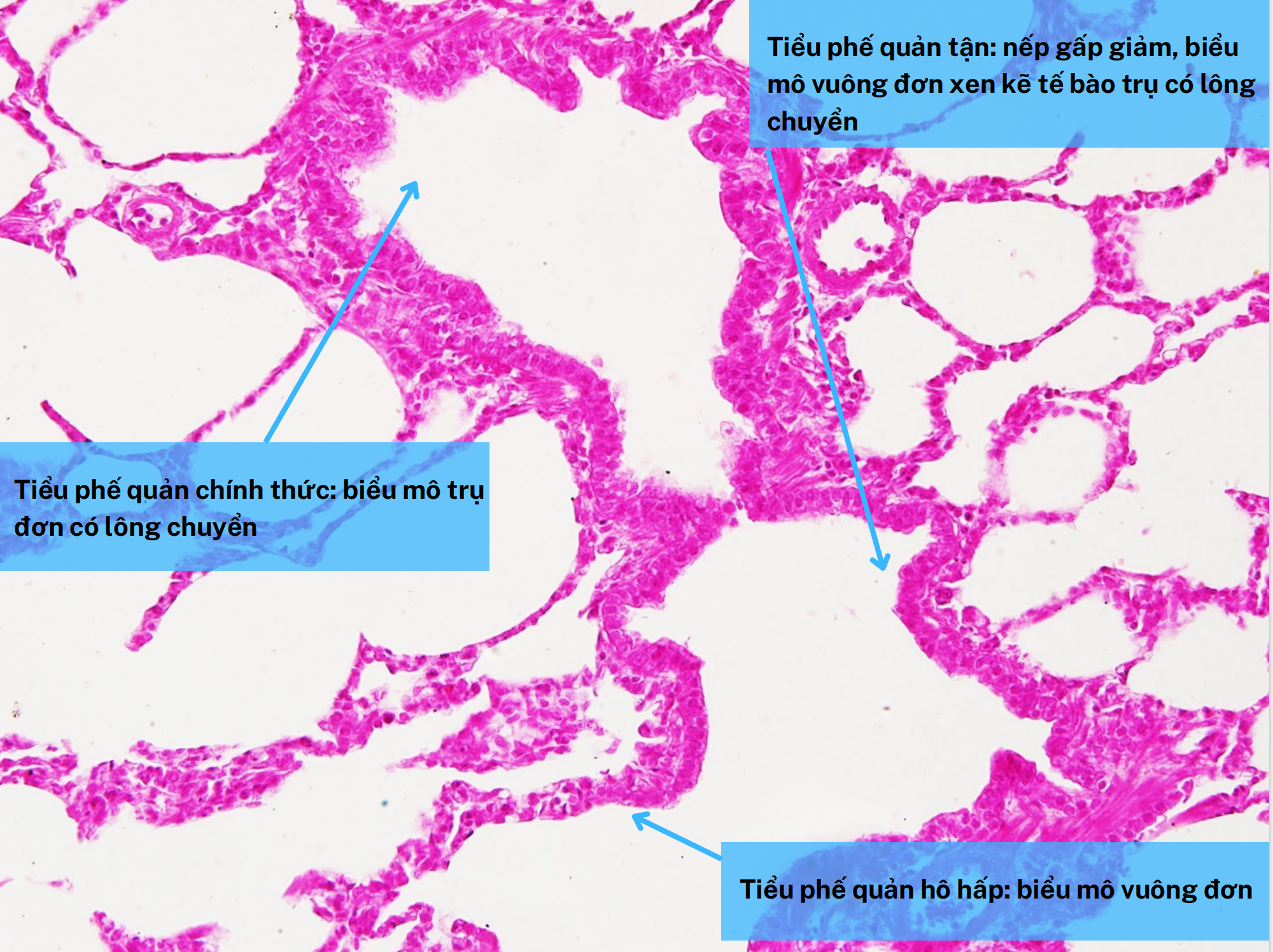 <ol><li><p>Tiểu phế quản tận</p></li><li><p>Tiểu phế quản chính thức</p></li><li><p>Tiểu phế quản hô hấp</p></li></ol><p></p>