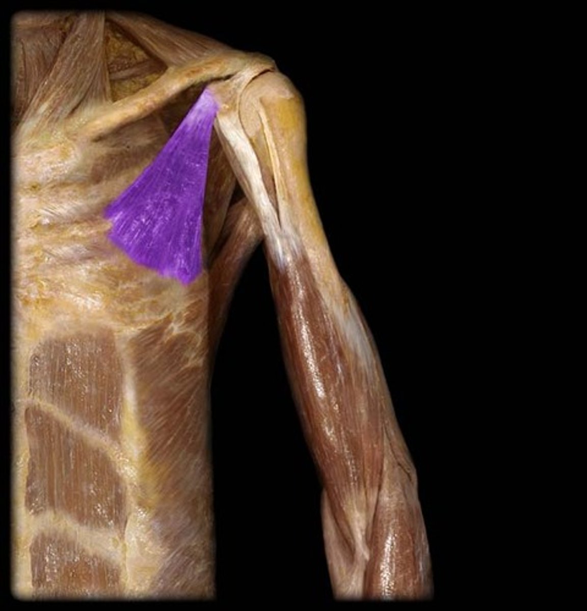 <p>Action - pulls the scapula forward and downward or raises the ribs</p>