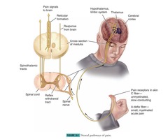 <p>Some type of tissue damage, serving as a warning signal.</p>
