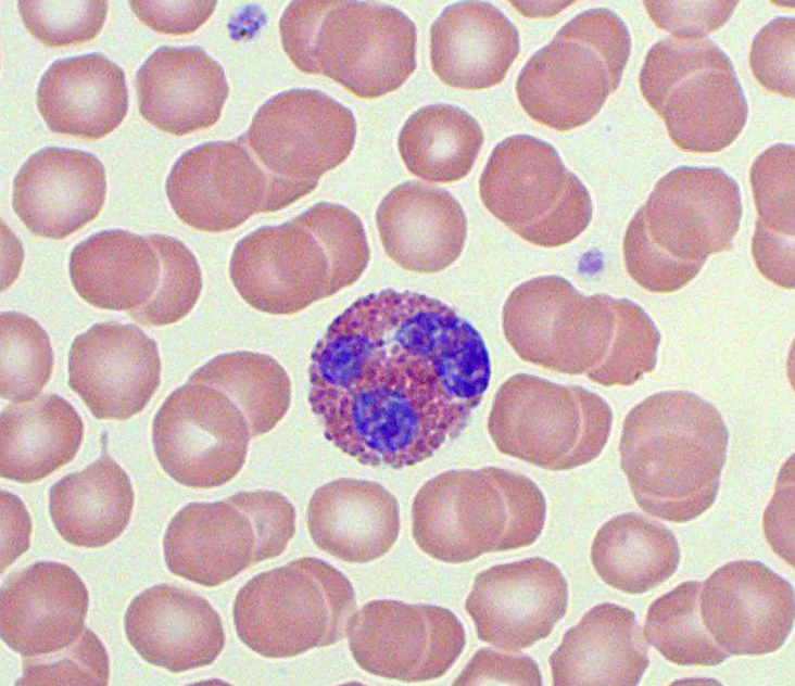 <p>Eosinophils decrease in what conditions?</p>