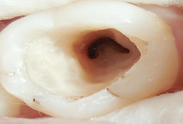 <p>What % of mandibular molars have a c-shaped canal?</p>