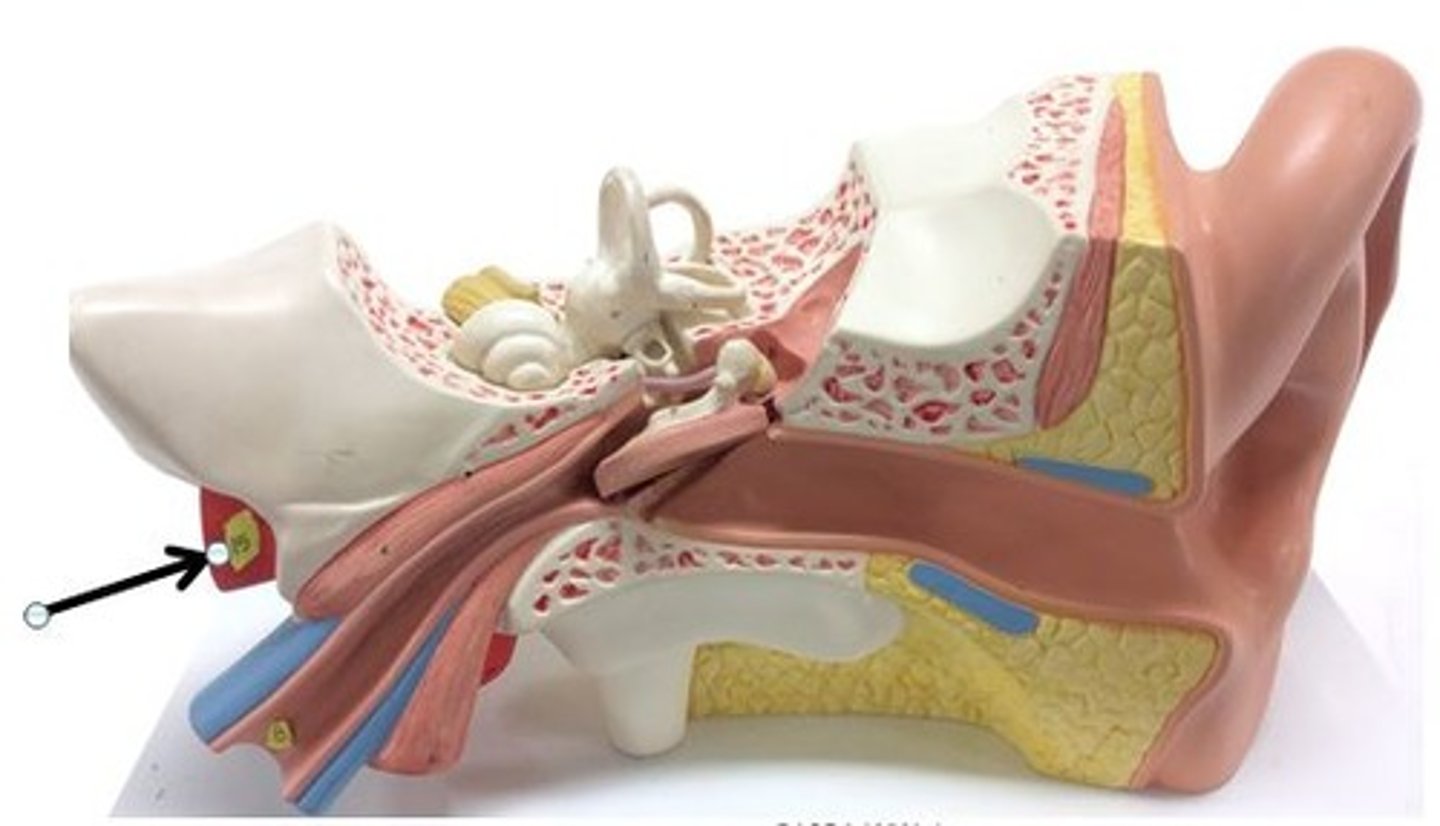 <p>Identify this blood vessel.</p>