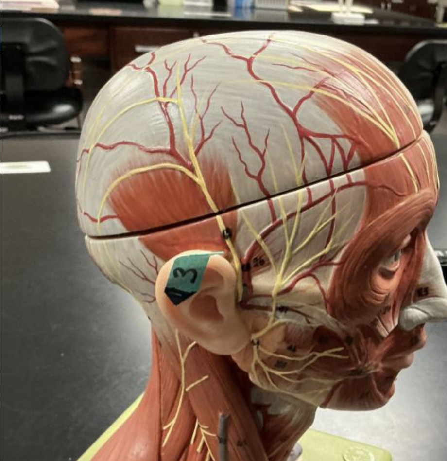 <p>____________ is the predominant connective tissue in the structure labeled 3</p>