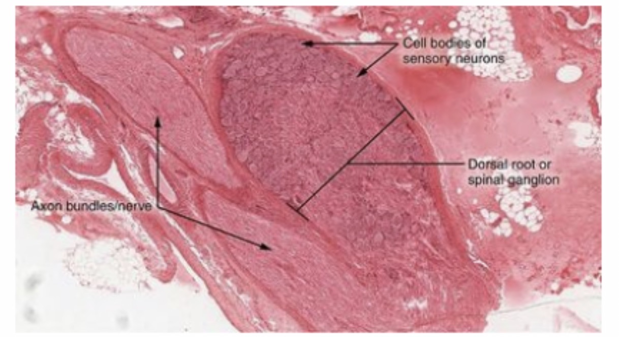 <p>Sensory Neuron (pseudounipolar) : Function : Carries sensory impulses from receptors to the central nervous system.</p>