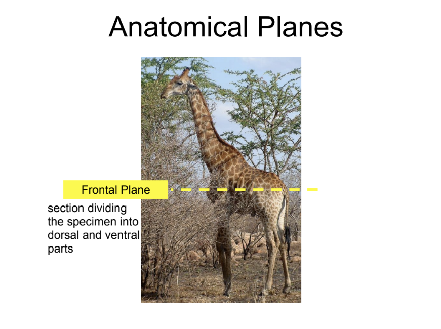 <p>frontal plane</p>