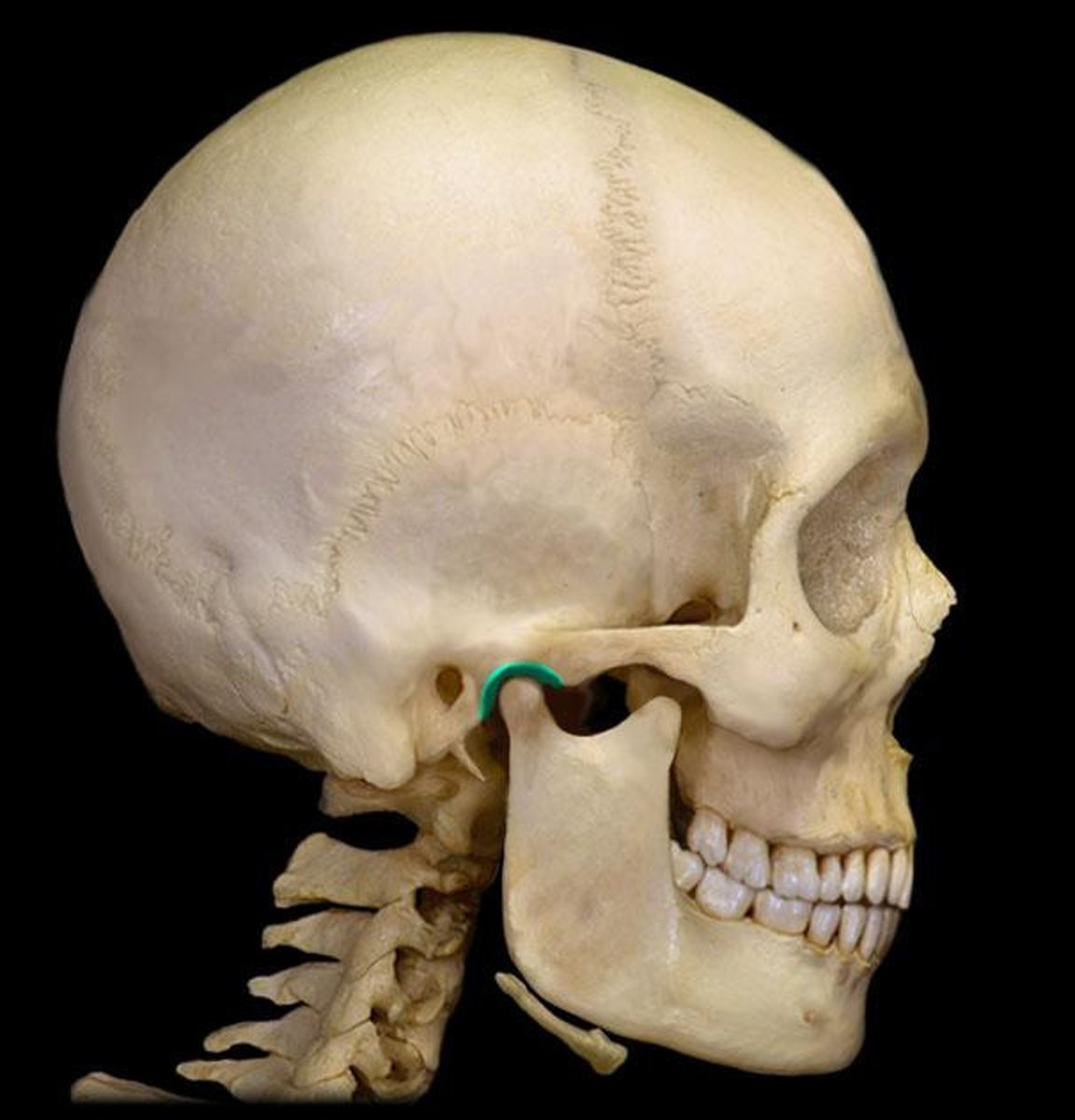 <p>What is this boney feature?</p>