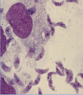 <ul><li><p>Toxoplasma gondii<span> </span></p></li><li><p><span>causes </span>toxoplasmosis</p></li></ul><p></p>