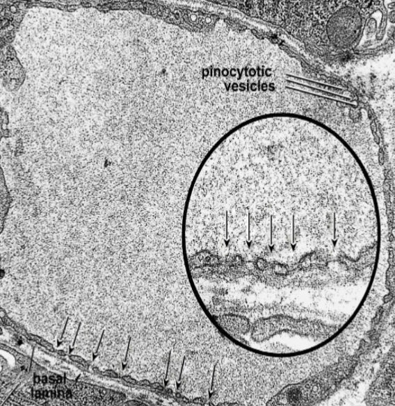 <p>What type of capillary is this?</p>