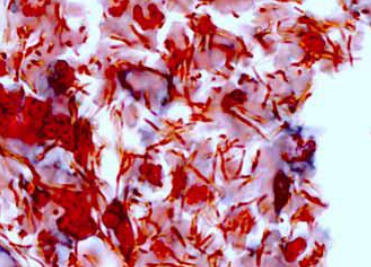 <p>PATHOGENIC BACTERIA: </p>