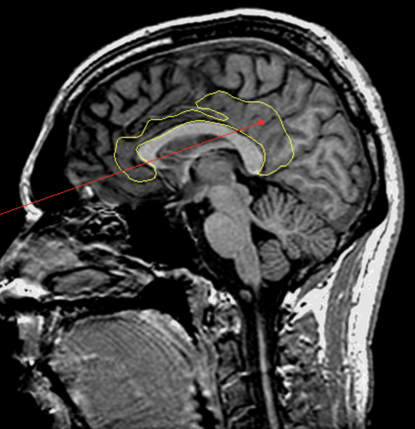 <p>What is the area highlighted called?</p>