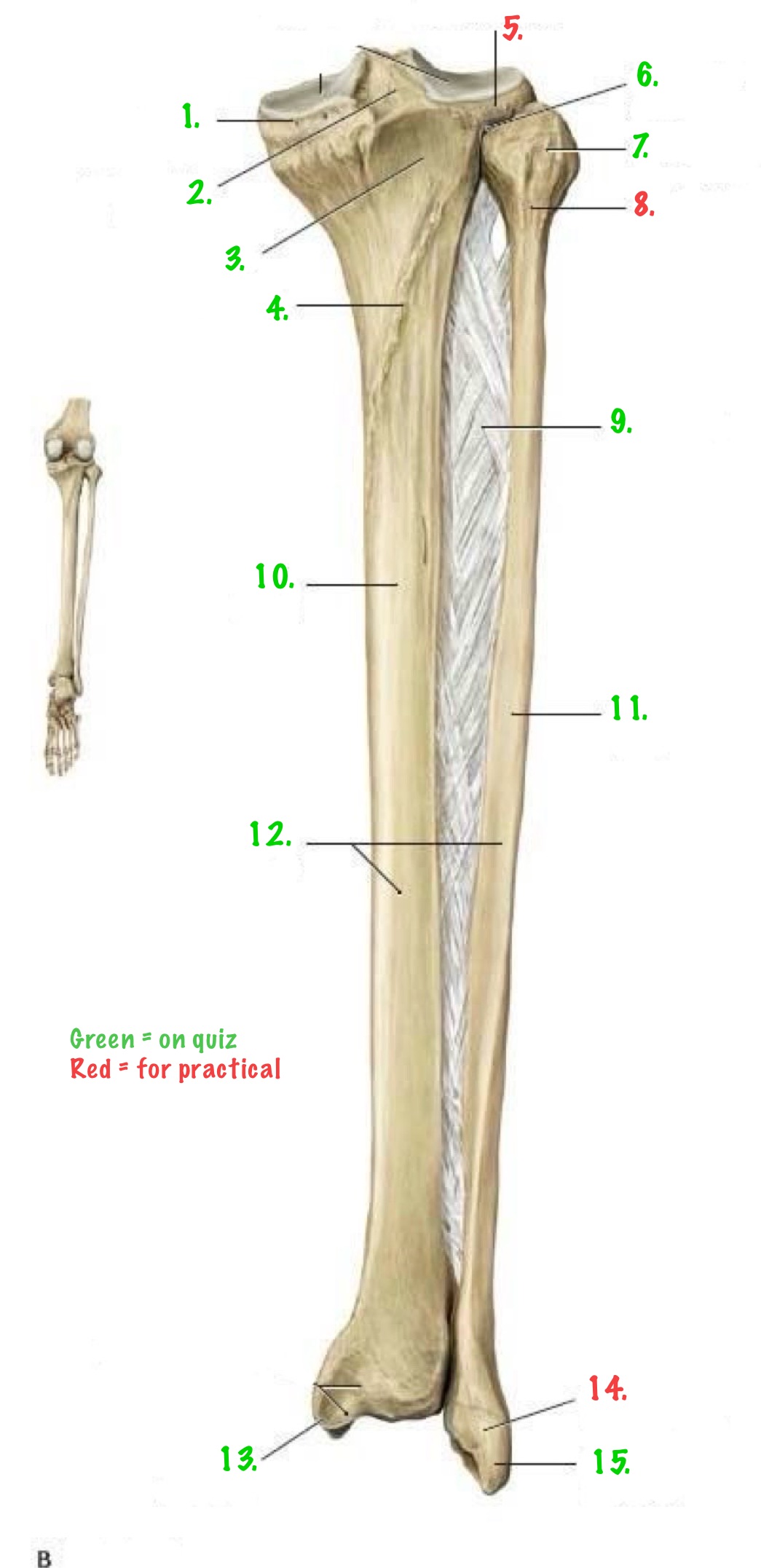 <p>Identify 13.</p>
